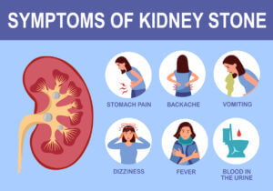 Kidney stone symptom infographic