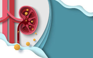Kidney stone human renal disease vector image