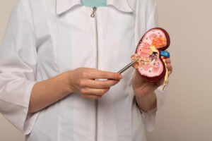 nephrologist pointing on anatomical kidney model in hand