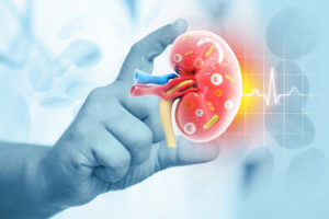 Glomerulonephritis - Associates in Nephrology