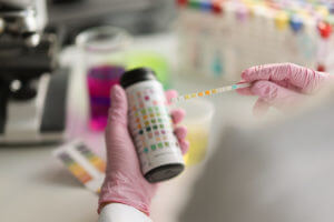 The doctor holds a reagent strip for urinalysis to check for protein in the urine.