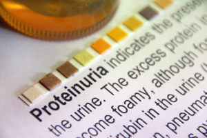 Protein Urinalysis