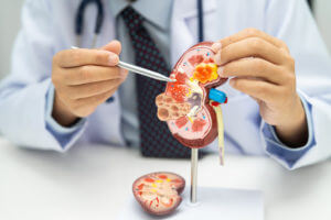 A nephrologist holds a human model to explain areas of nephrology related to kidney conditions and diseases, such chronic kidney disease (CKD).