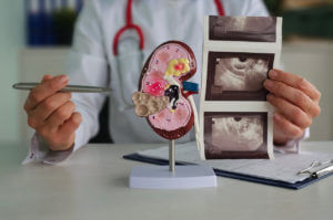 A nnephrologist examines kidney model and ultrasound images in clinic consultation.