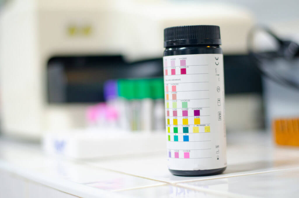 Urine strip with scientist in lab, checking for protein in your urine.