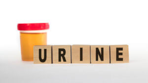 Healthcare and medical concept with text URINE