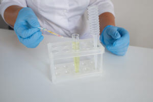 Urinalysis or urine test with express strips that checks for protein in urine.