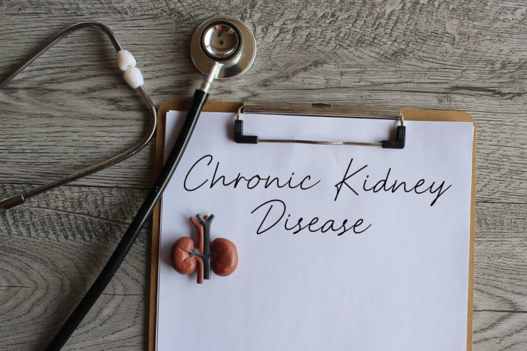 Stethoscope, kidney model and paper clipboard with text Chronic Kidney Disease.