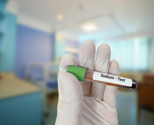 Blood sample for Sodium test